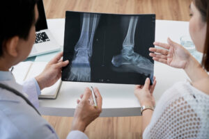 An IntegraMed orthopedic surgeon reviews a patient’s foot X-ray,
