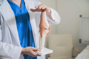 Medical professional holding a knee joint model during a patient education session about knee anatomy, rehabilitation, and knee arthroplasty surgery FAQs.