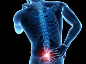 Illustration of severe lower back pain highlighting symptoms that may require medical evaluation after artificial disc replacement surgery