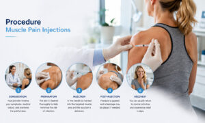 Infographic illustrating the muscle pain injection procedure, including consultation, skin preparation, targeted injection, post-treatment care, and recovery.